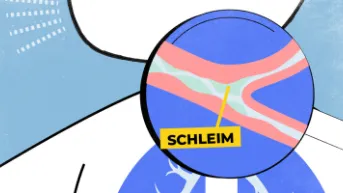 RSV-Infektion verursacht Schleimbildung